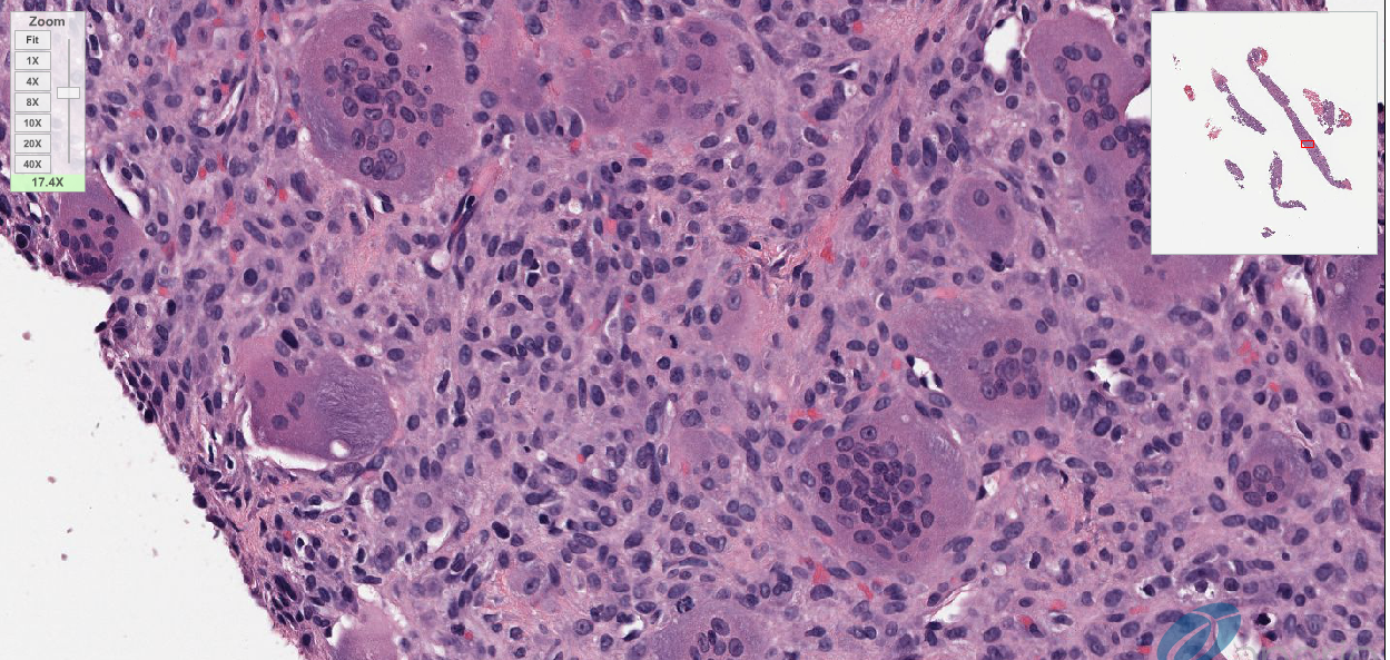 JBJS Case Connector Debuts WholeSlide Images OrthoBuzz