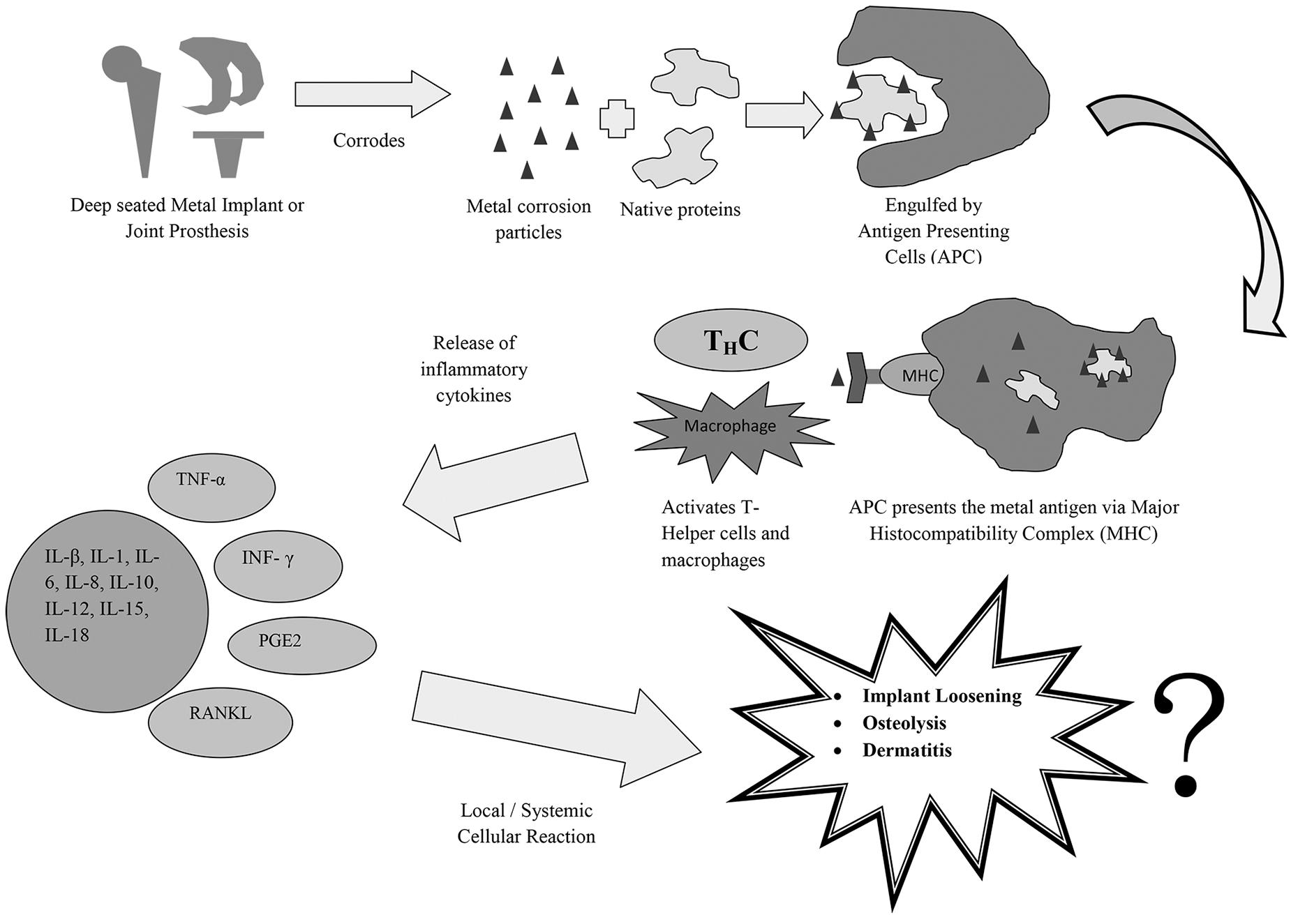 Prosthetic Metal Allergies The Mystery Continues OrthoBuzz   Metal Hypersensitivity For Obuzz 