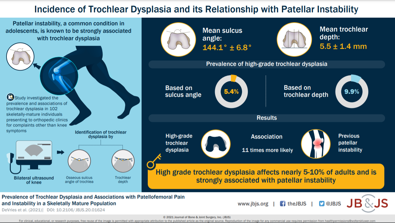 Trochlear Dysplasia