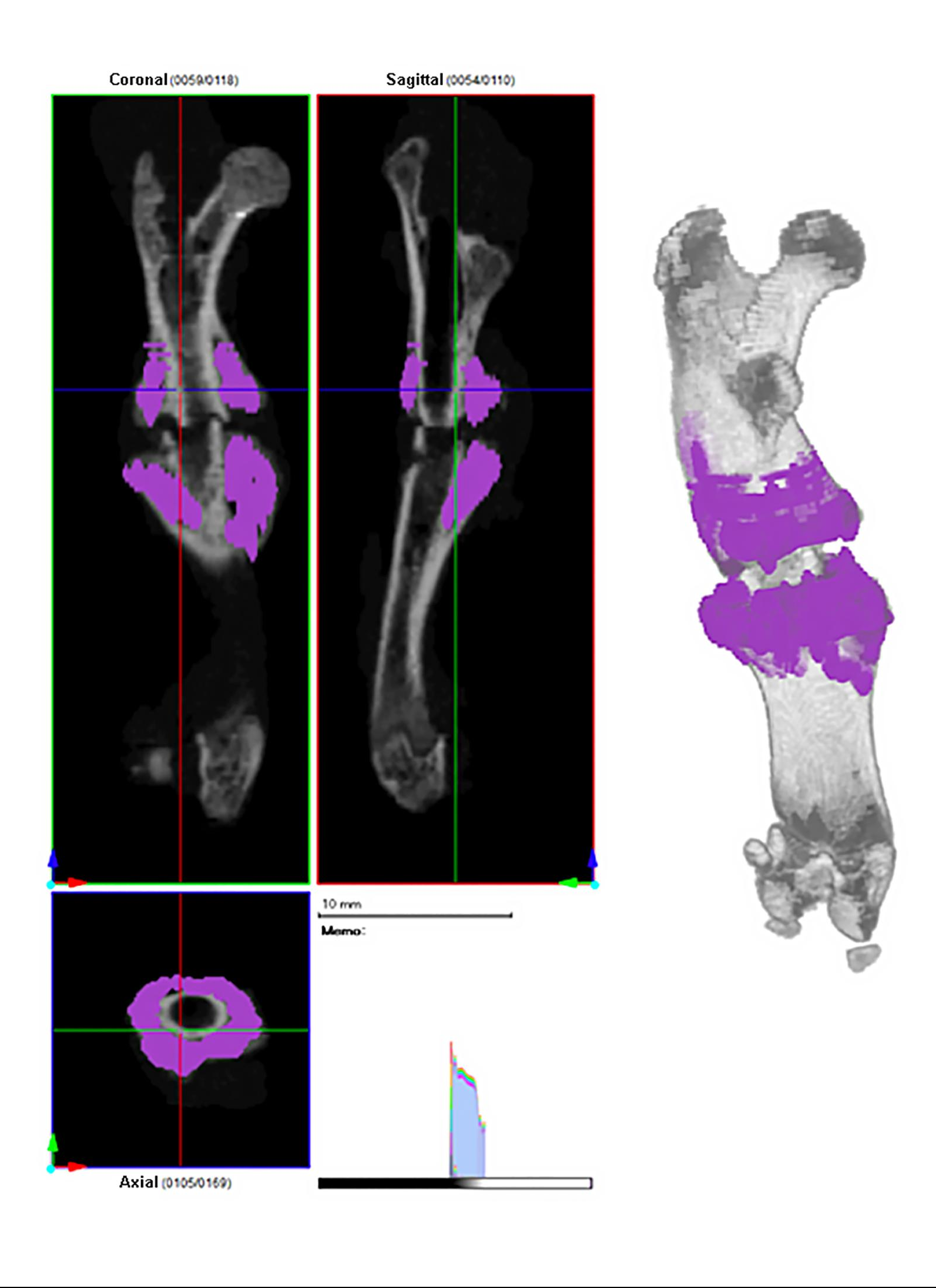New bone volume was calculated with use of 3D image processing software