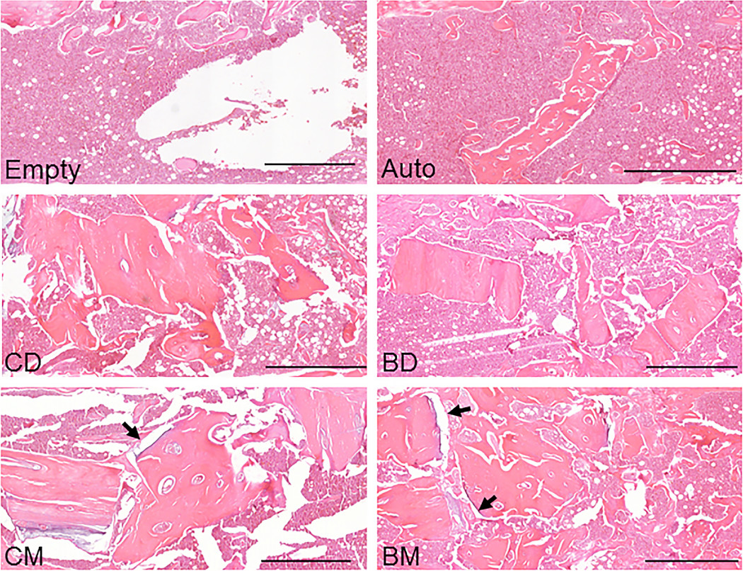 Hematoxylin and eosin staining of allograft particulate implanted in 3-mm femoral defects at 10 weeks postoperatively.