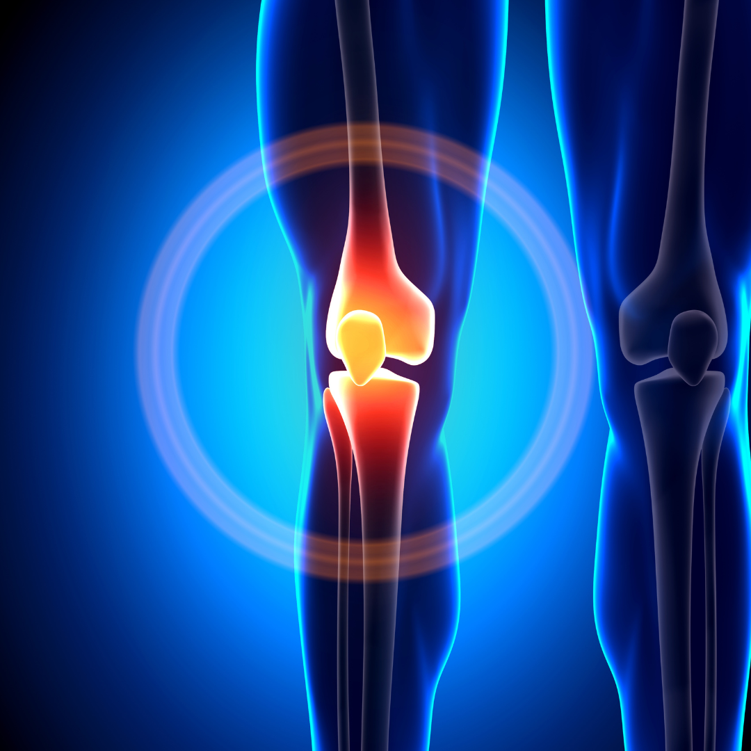 X-ray graphic of knee anatomy.