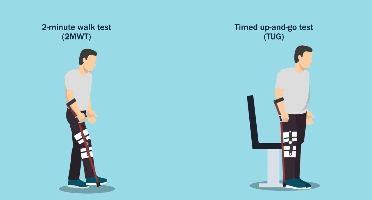Illustration depicting the 2-minute walk test (2MWT) and the Timed Up-and-Go Test (TUG) in patients undergoing unicompartmental knee arthroplasty vs. total knee arthroplasty.