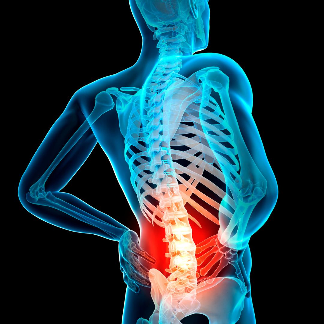 Anatomical illustration of spine pain.