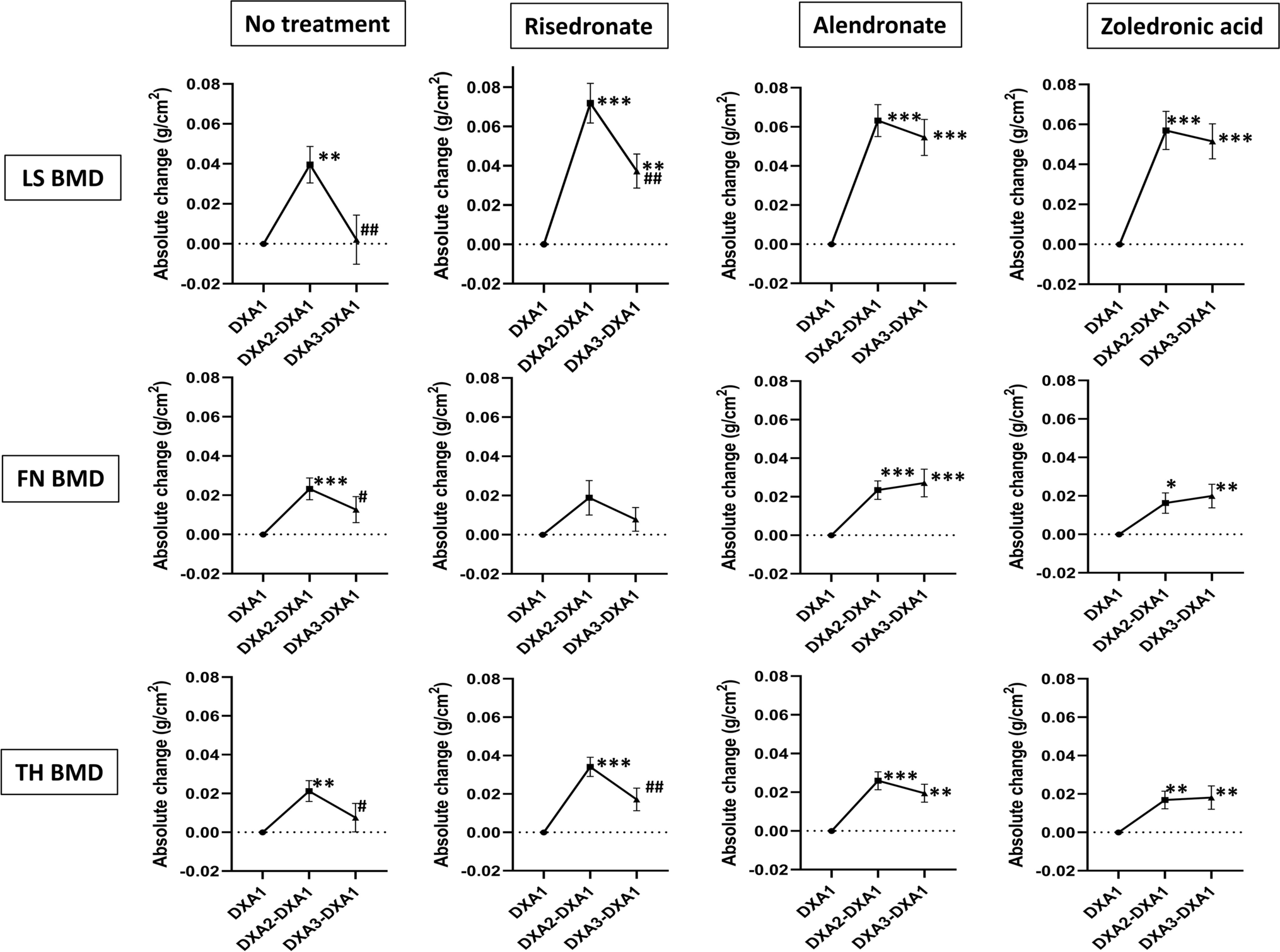 Graphs depicting absolute change (mean ± SEM) in LS, FN, and TH BMD during denosumab treatment and after receiving no subsequent therapy or received subsequent treatment with risedronate, alendronate, or zoledronic acid. From "Bone loss after denosumab discontinuation is prevented by alendronate and zoledronic acid but not risedronate: a retrospective study."