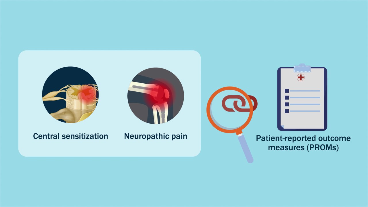 Investigating the link between central sensitization and neuropathic pain and patient-reported outcome measures.