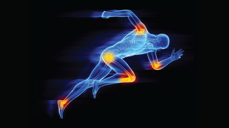X-ray illustration of a runner