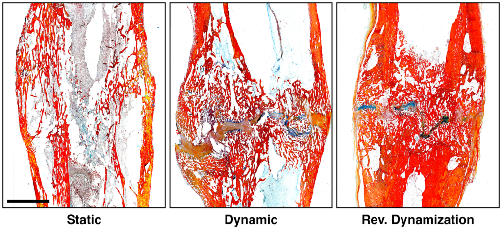 What’s New In Limb Lengthening And Deformity Correction 2024 - OrthoBuzz