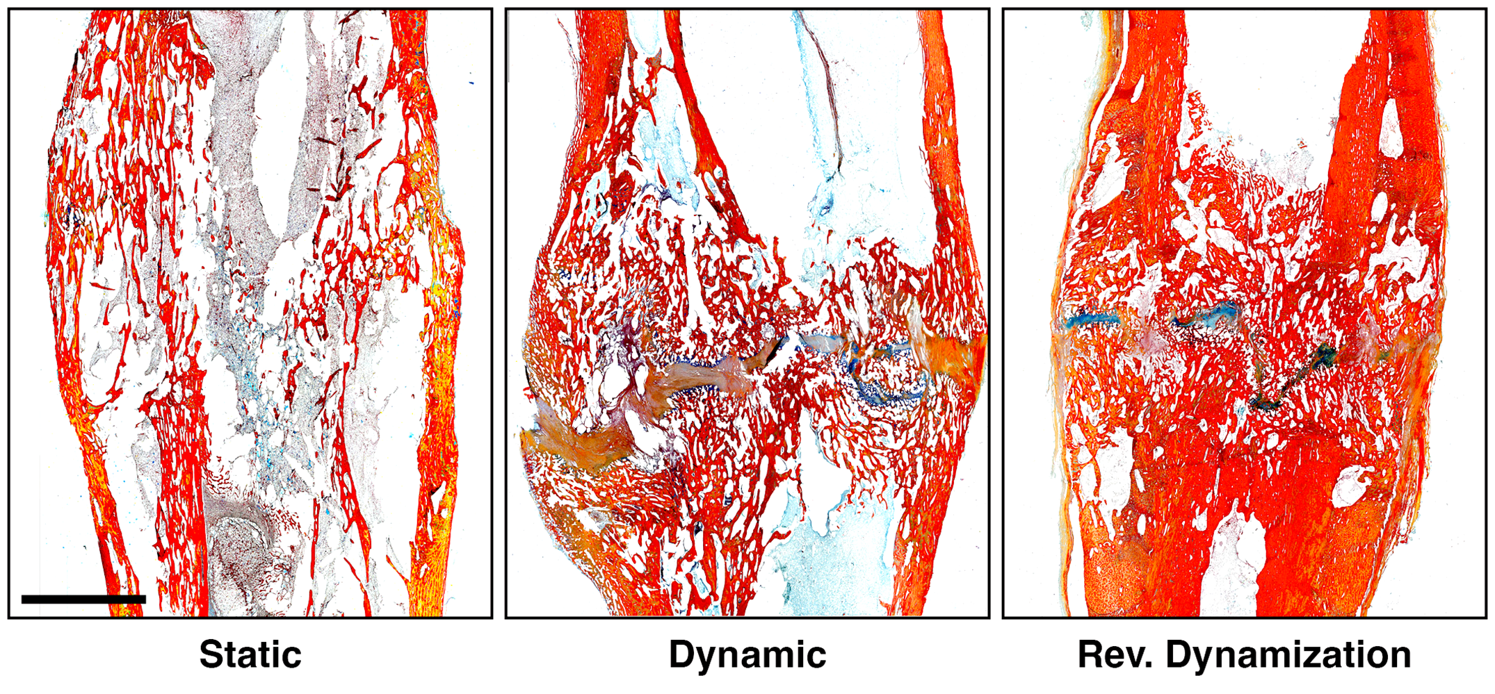 Representative histological images of tibiae from 3 goats that underwent distraction osteogenesis and stabilization with static fixation, dynamic fixation, or reverse dynamization.