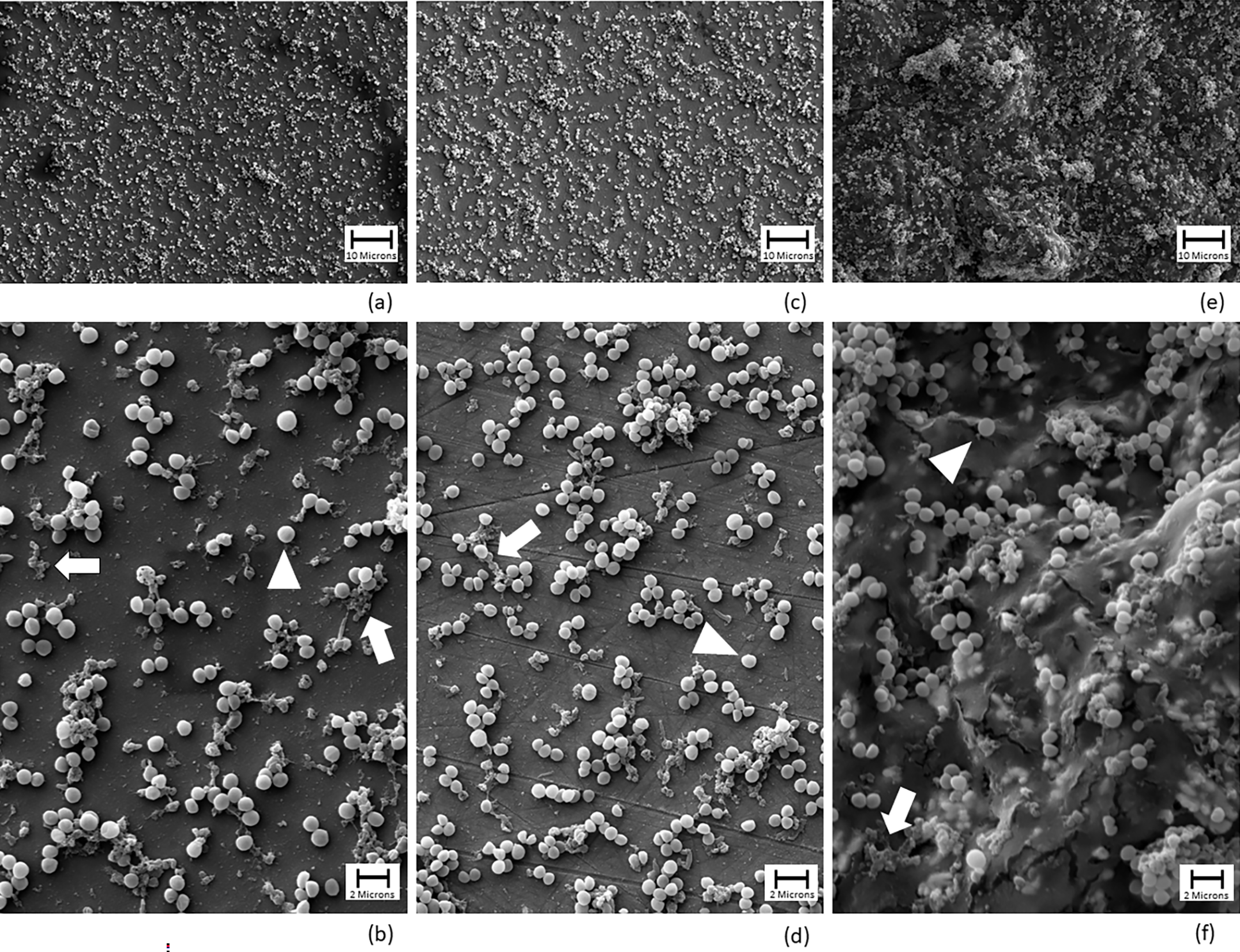 SEM imaging of Xen 36 biofilm on CC surfaces, OxZr surfaces, and PMMA surfaces 72 hours after inoculation with MSSA.