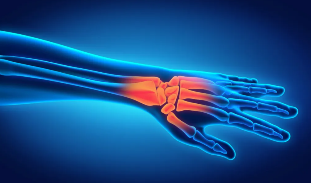 Illustration of hand and wrist anatomy.