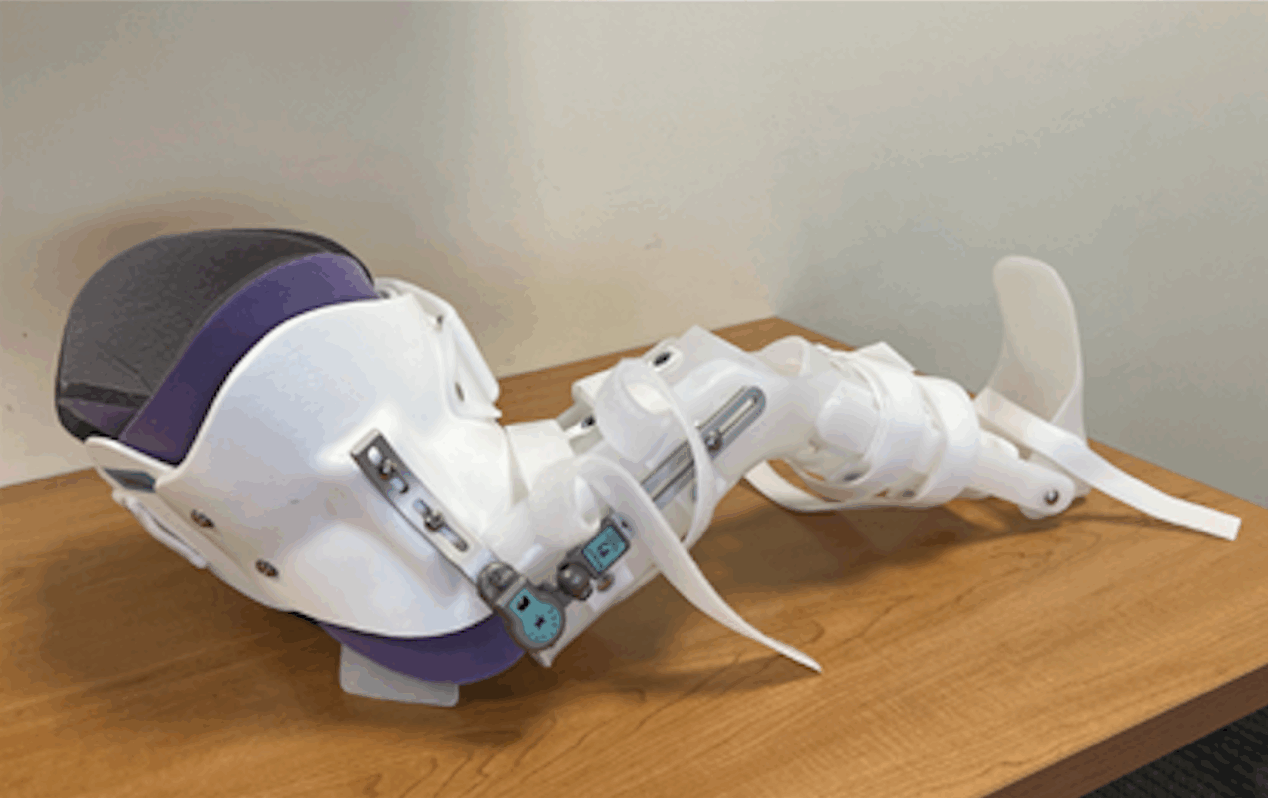 An example of the functional femoral brace.
