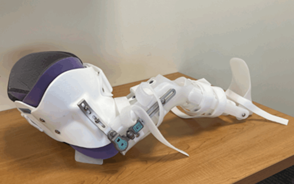 An example of the functional femoral brace.