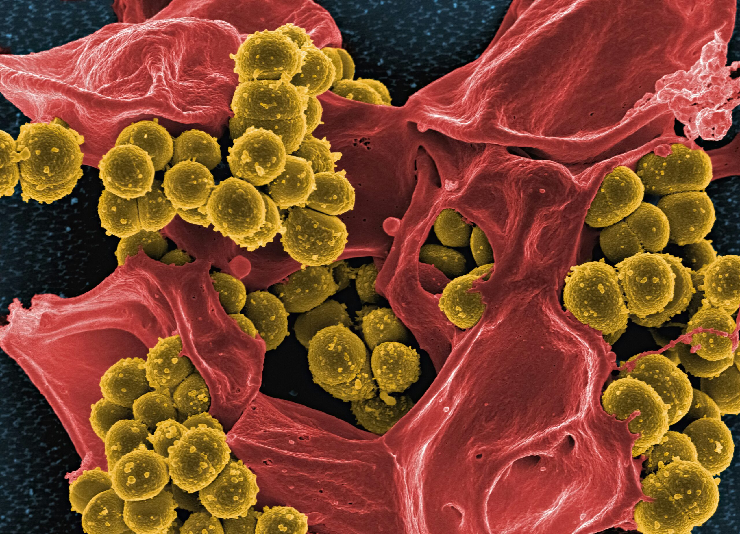 Methicillin-Resistant Staphylococcus aureus (MRSA) Bacteria Colorized scanning electron micrograph of methicillin-resistant Staphylococcus aureus (MRSA) bacteria (gold) interacting with a human neutrophil (red).