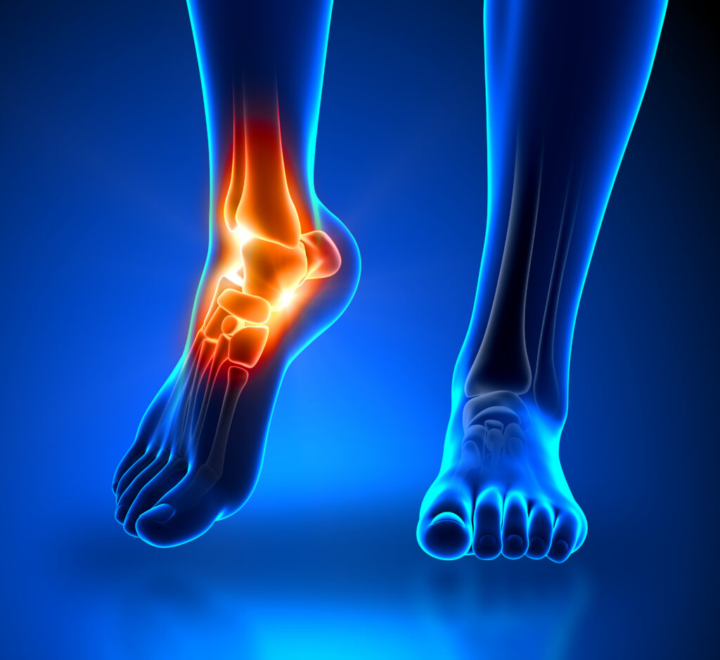 Graphic illustration of foot and ankle anatomy.