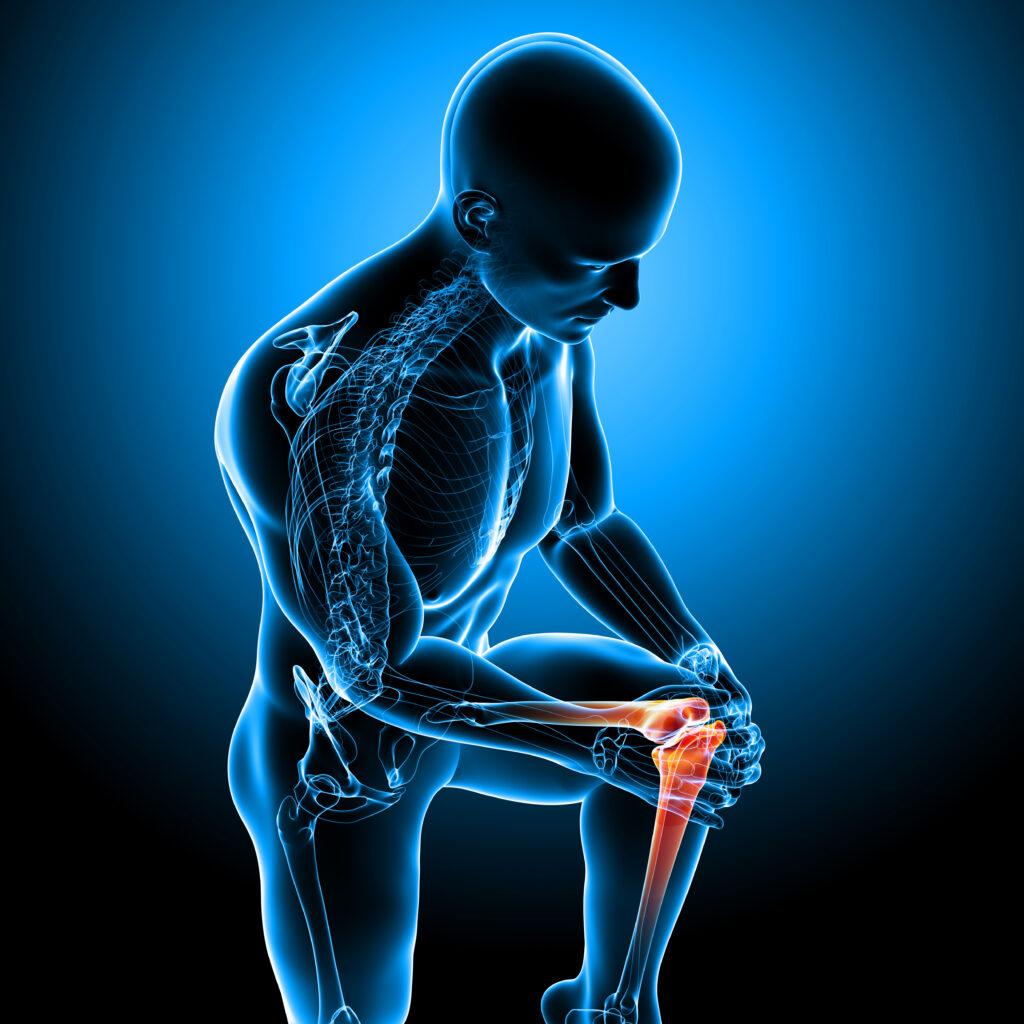 Graphic illustration of knee anatomy and pain.
